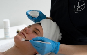 Zabieg na przebarwienia Yasumi