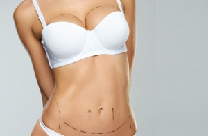 Powiększenie piersi – implanty, czy lipofilling?